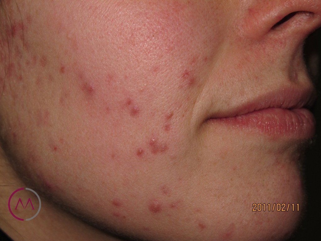 Before image