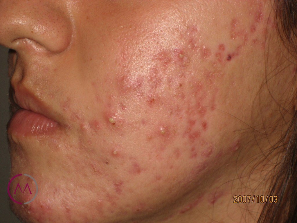 Before image
