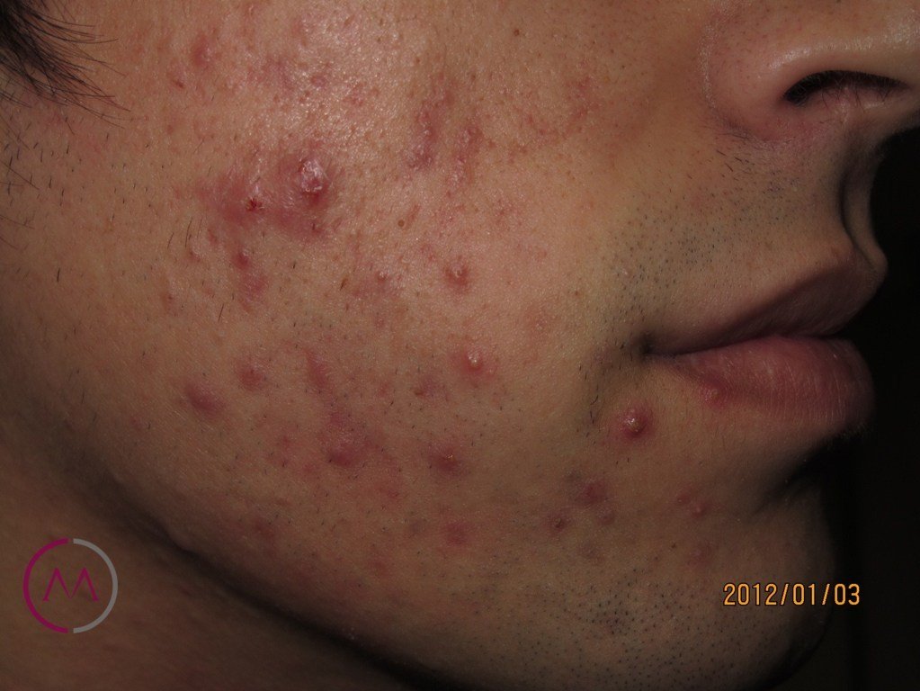 Before image