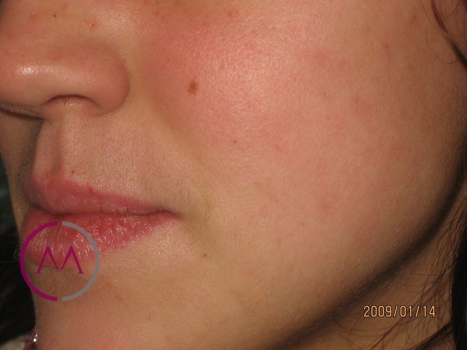 After image