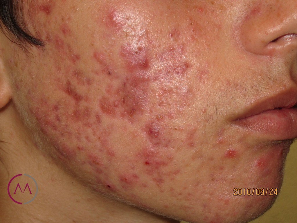 Before image