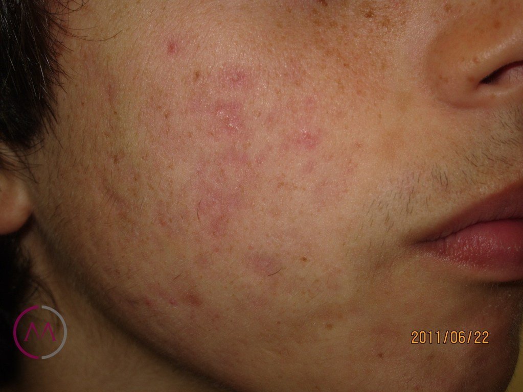 After image