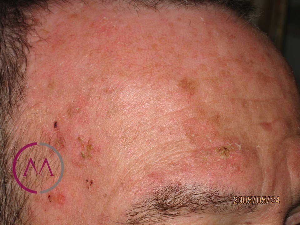 Before image