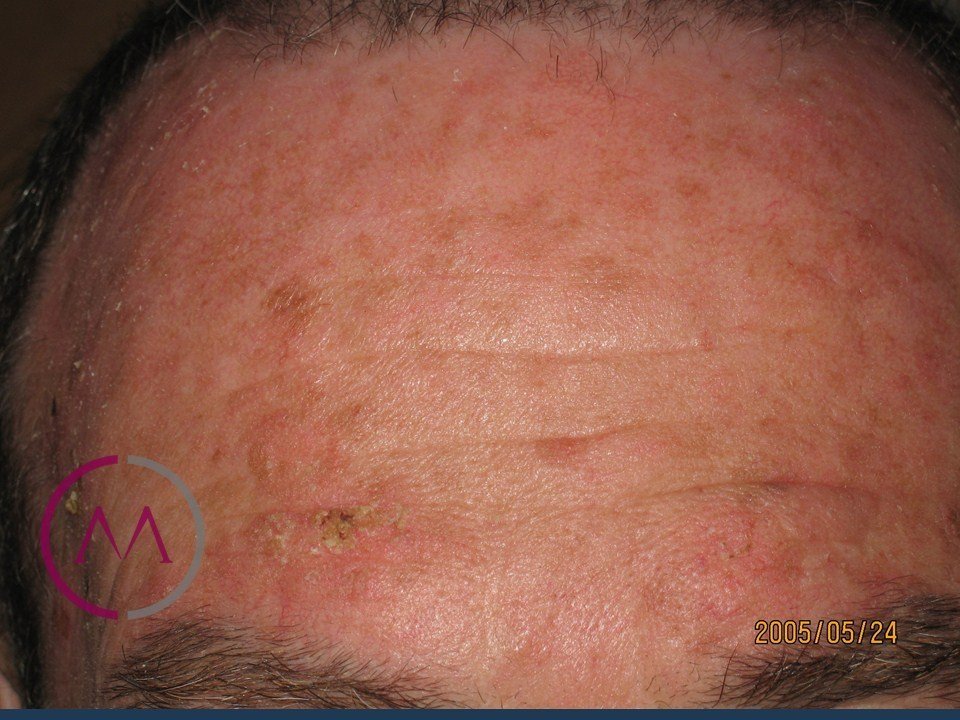Before image