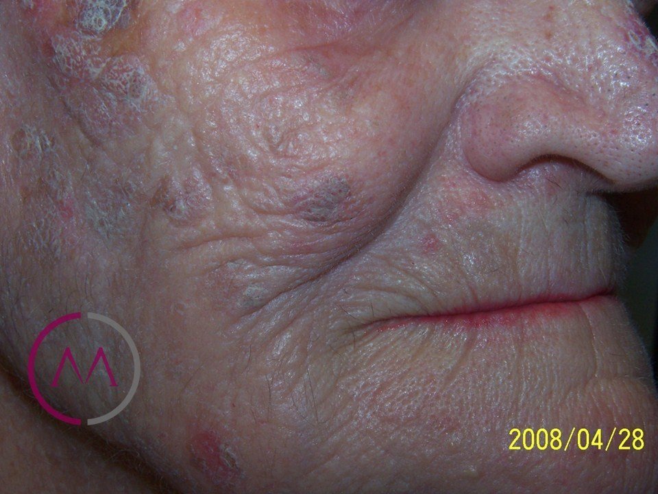 Before image