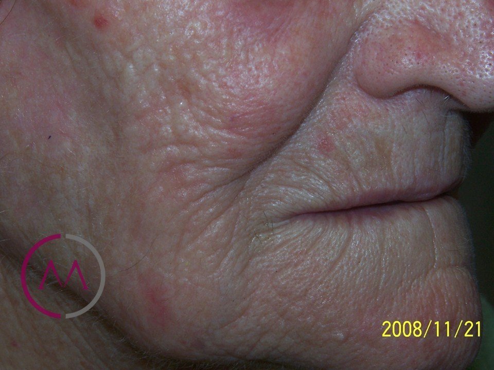 After image