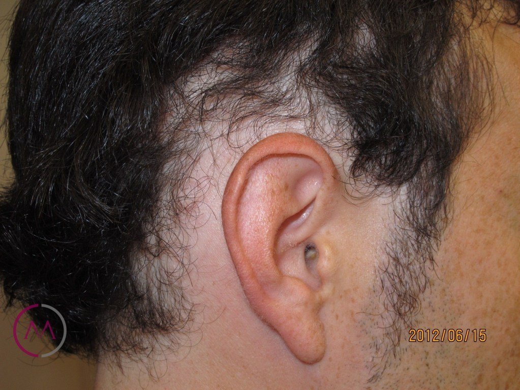 Before image
