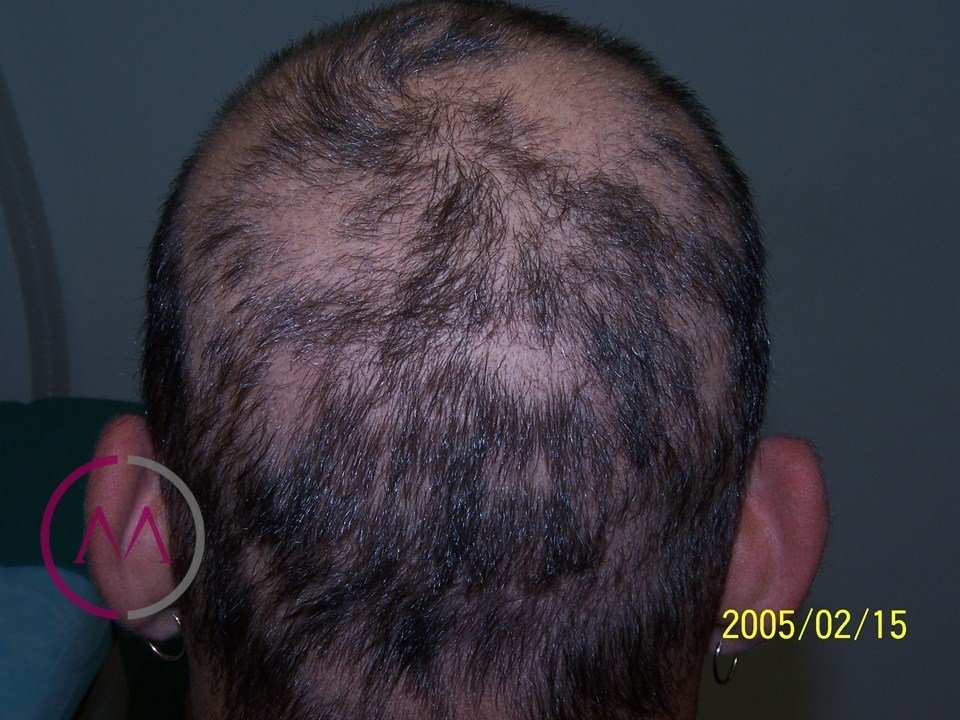 Before image