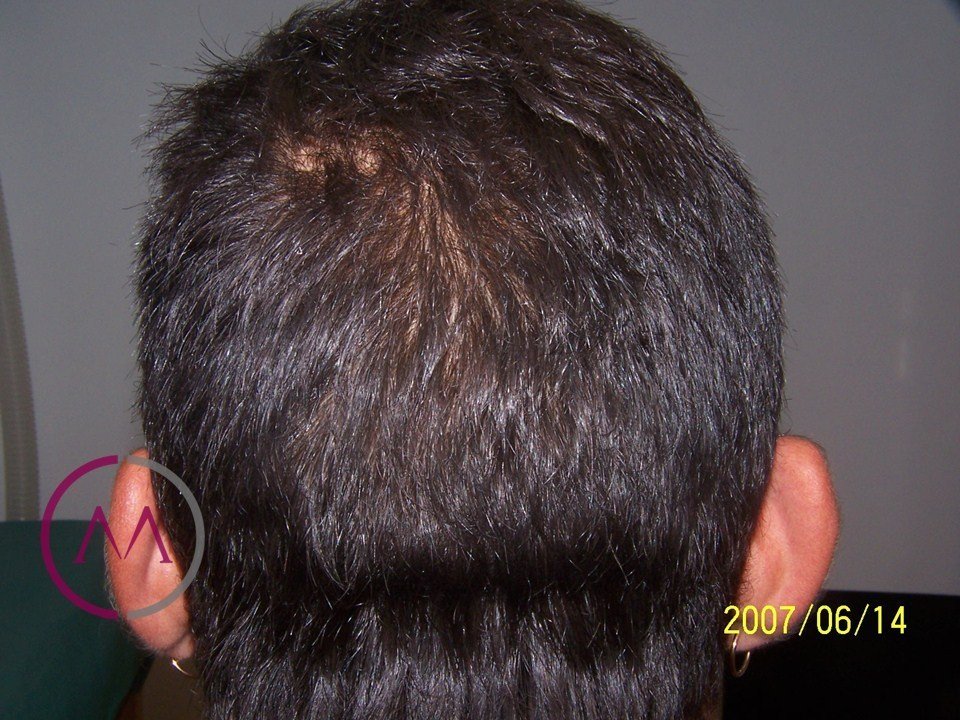 After image