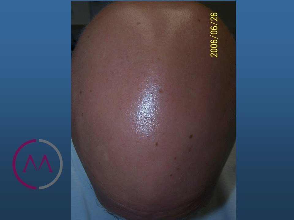 Before image