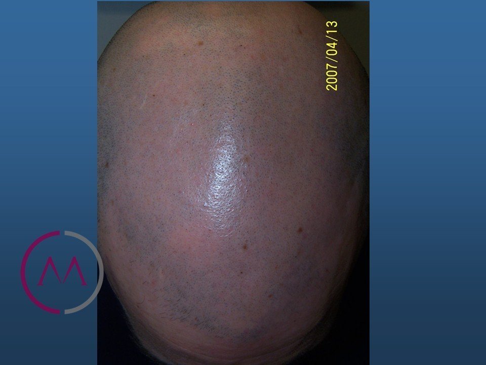After image