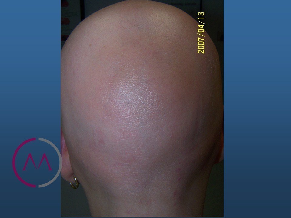 Before image