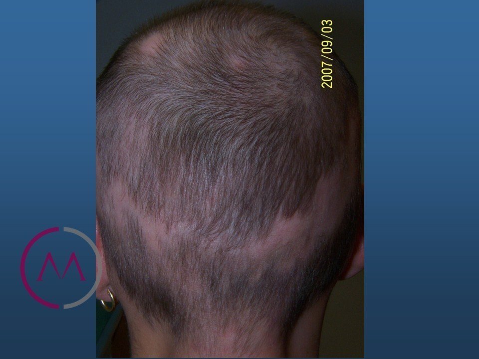 After image