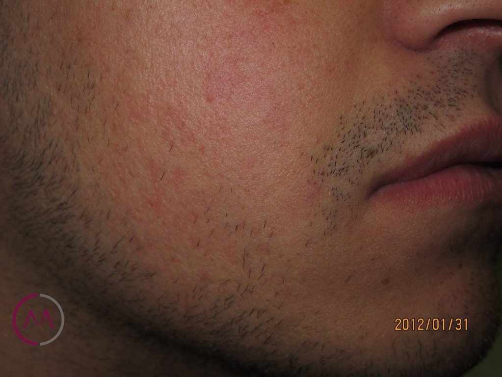 After image