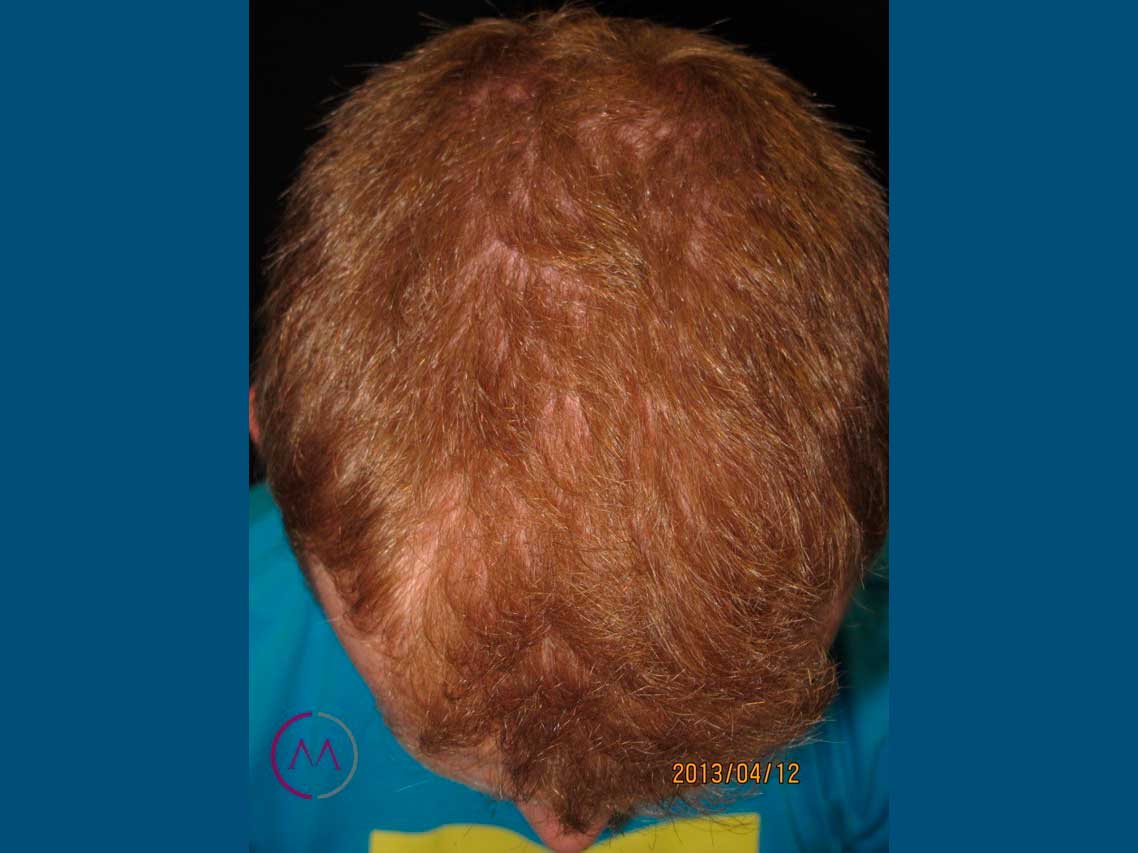 Before image