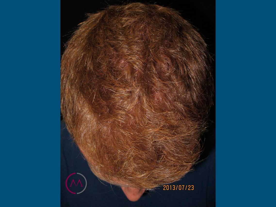 After image