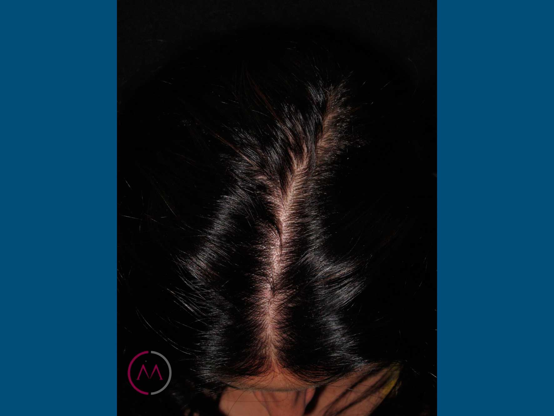 After image