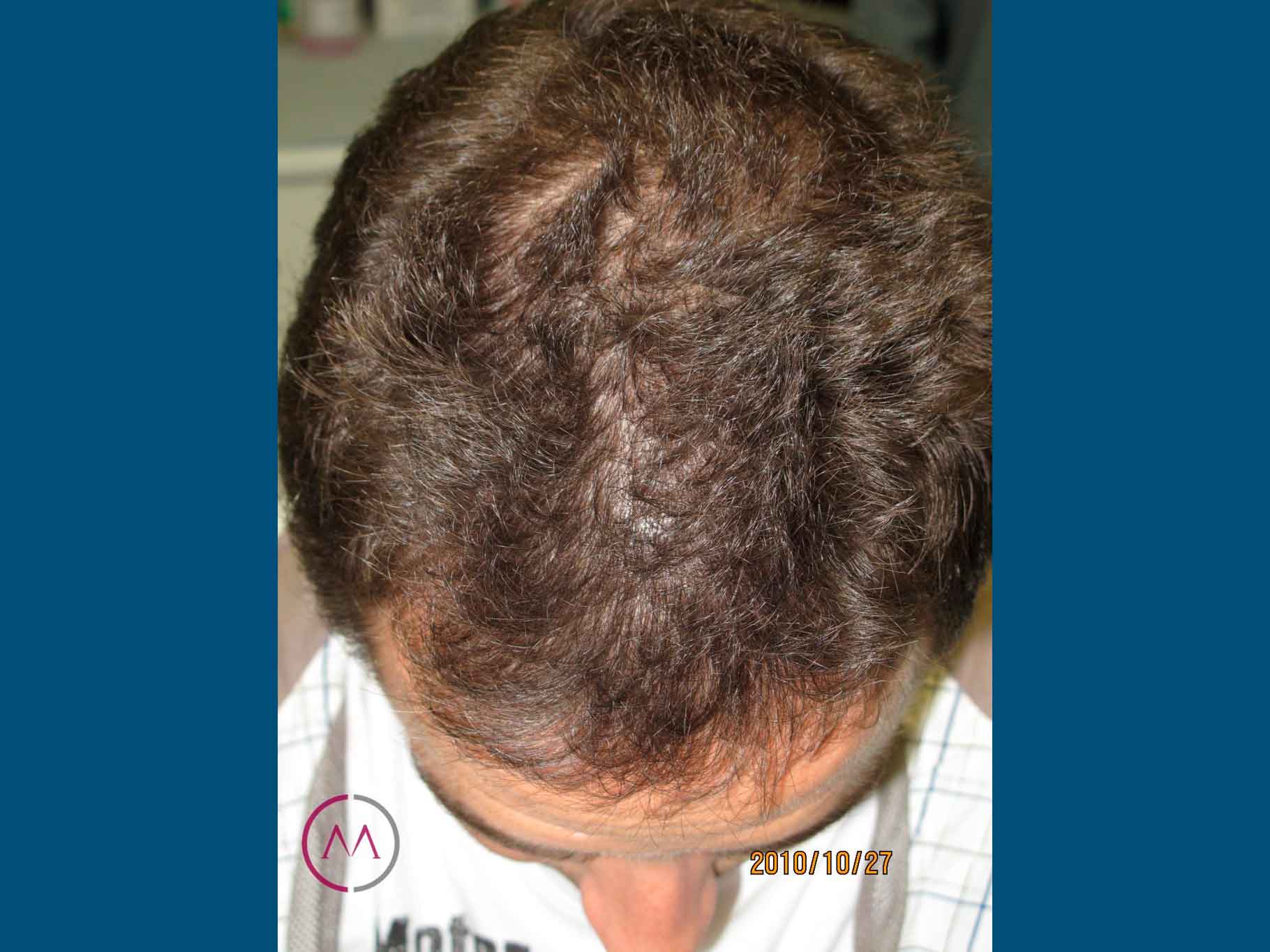 Before image