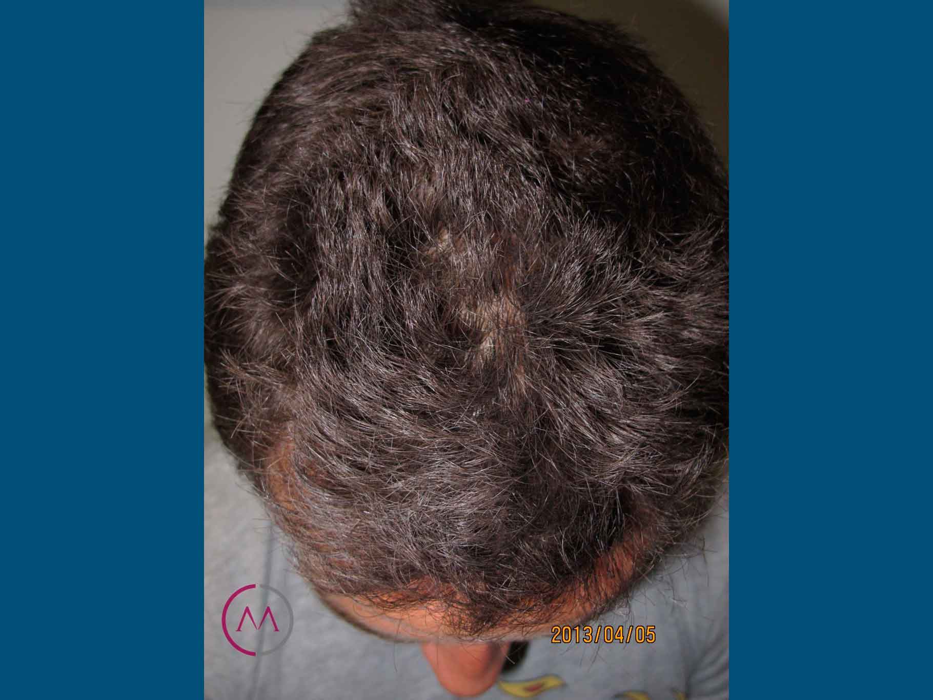 After image