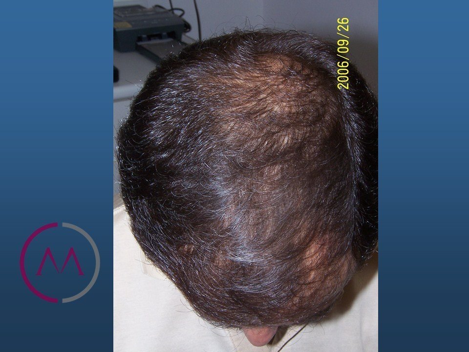 Before image