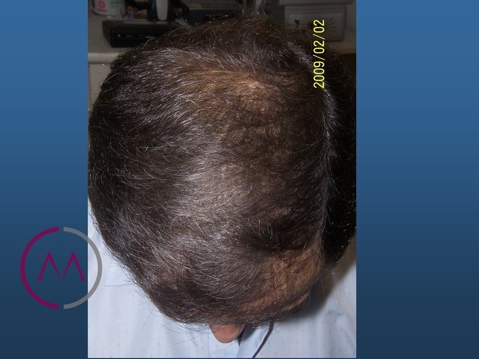 After image