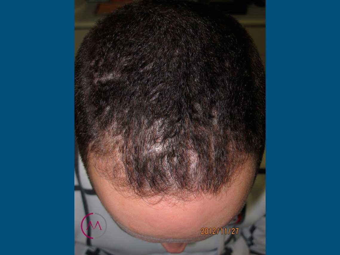 Before image