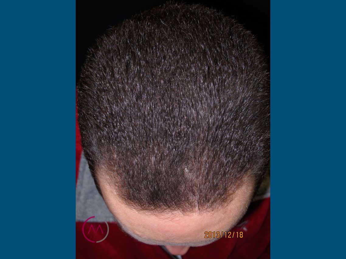 After image