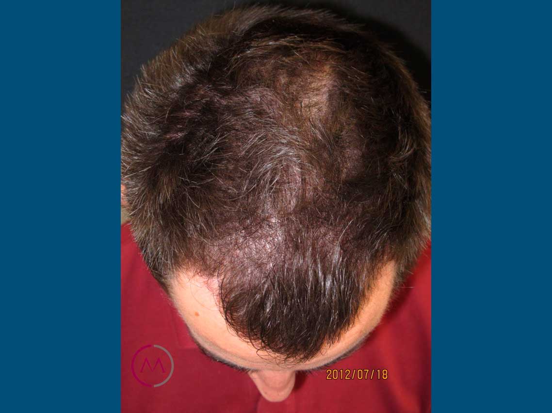 After image