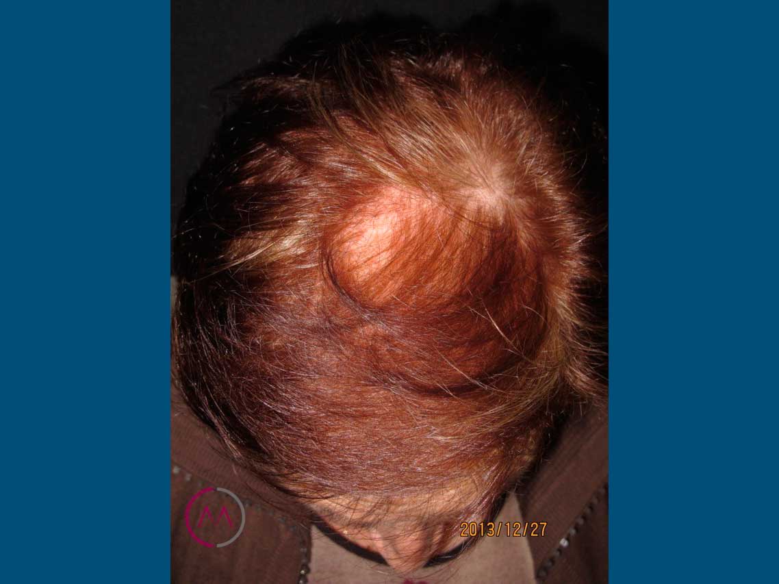Before image