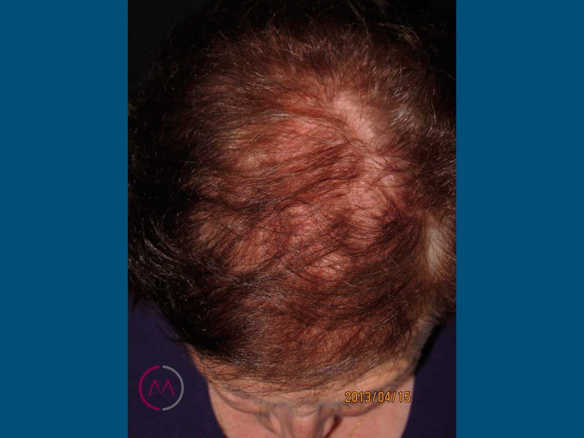 After image