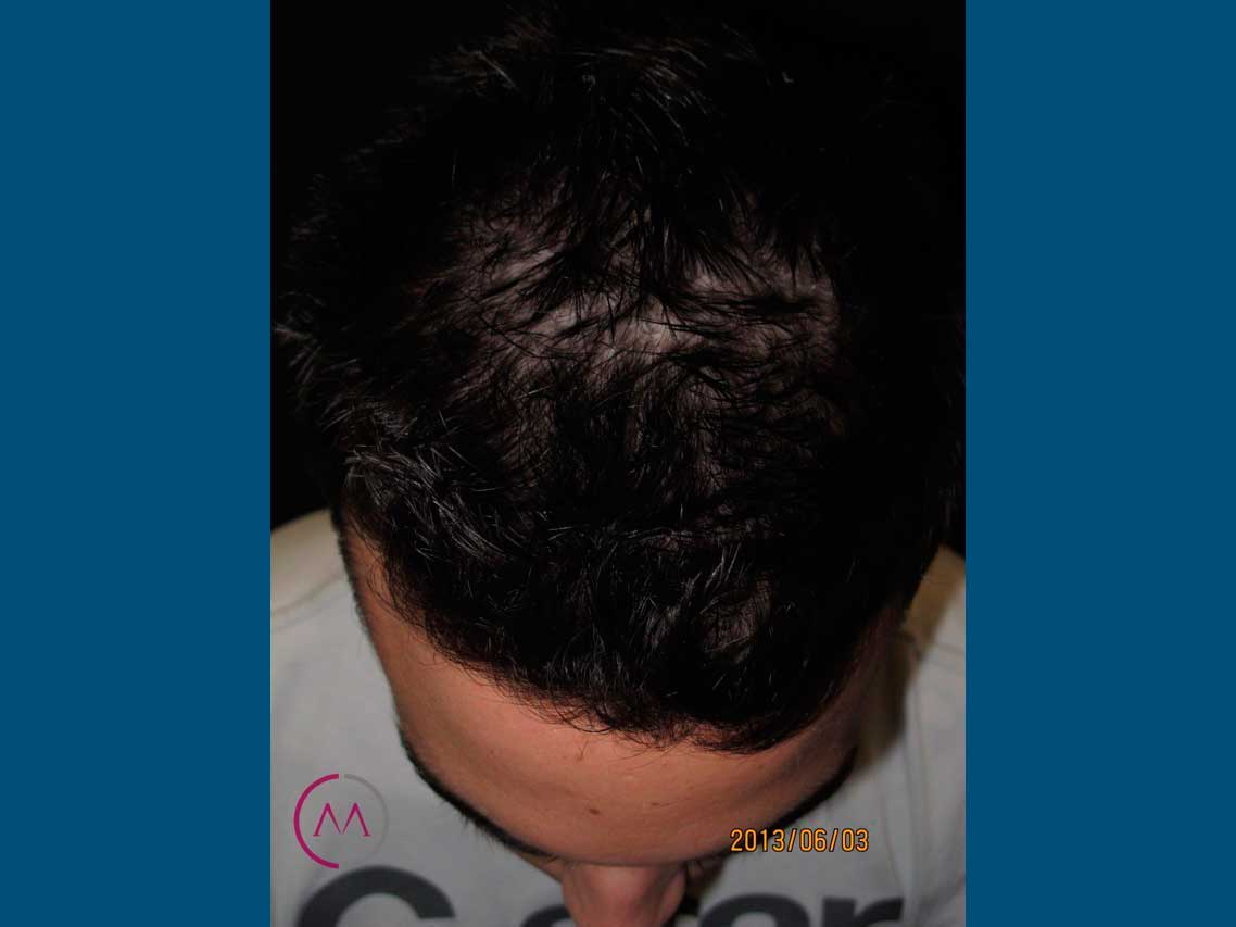 Before image