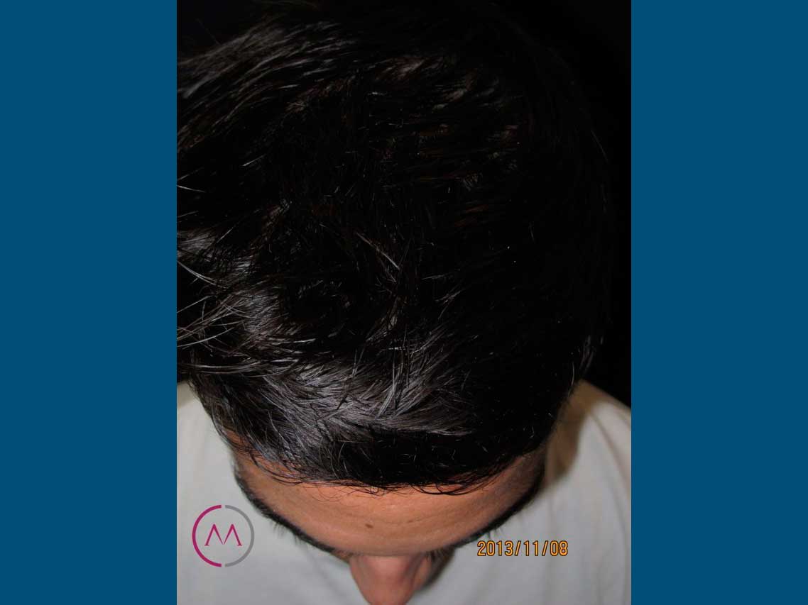 After image