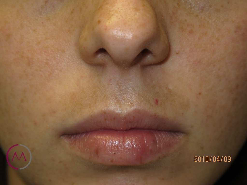 After image