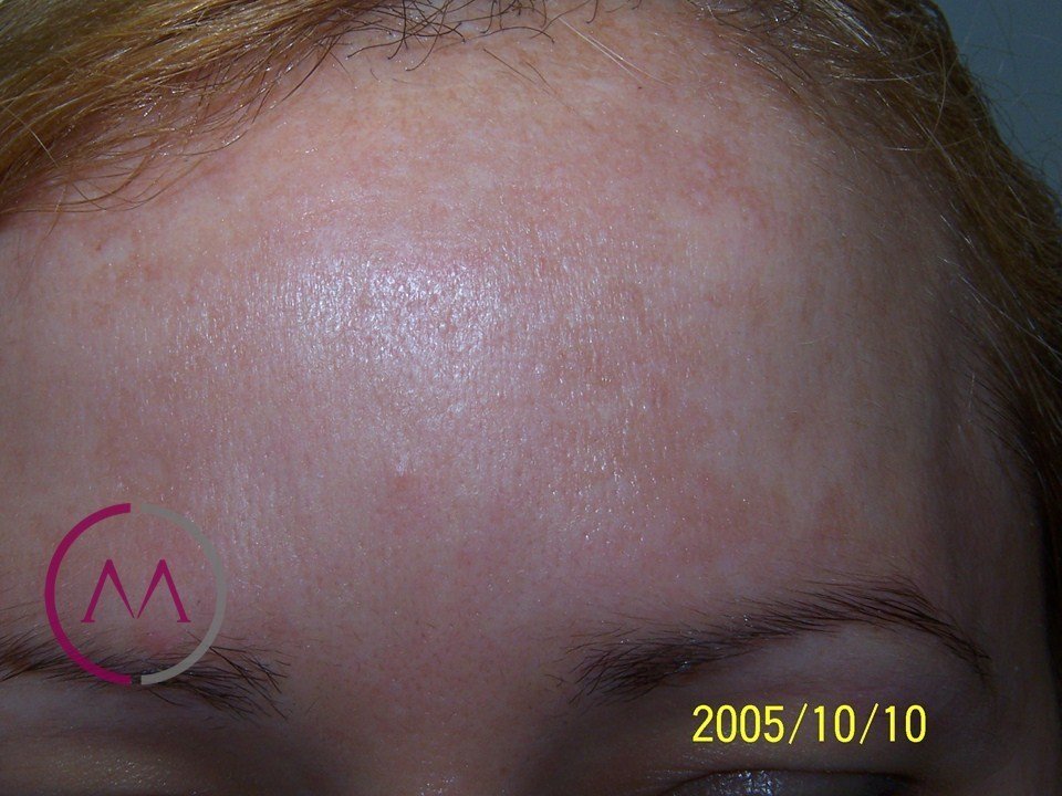 After image