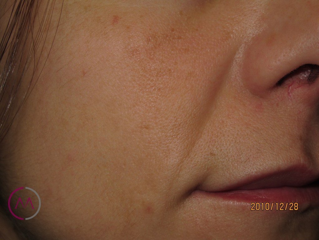 After image