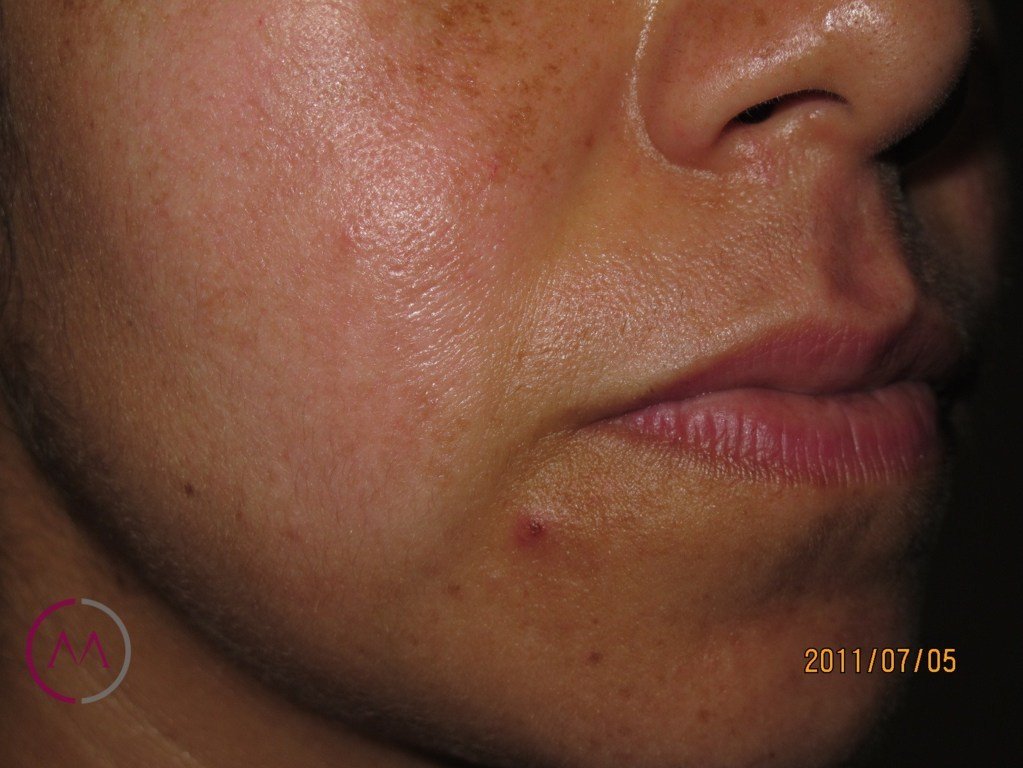 After image