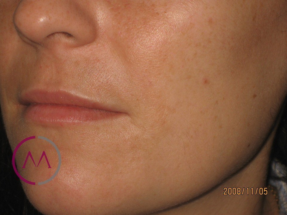 After image