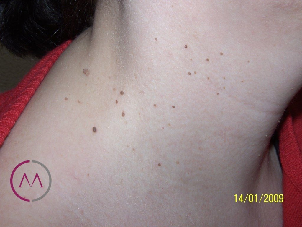 Before image