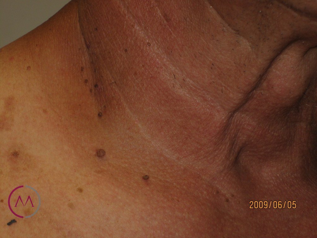 Before image