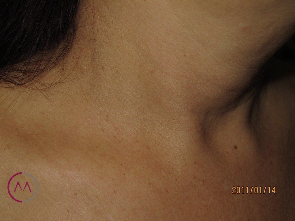 After image