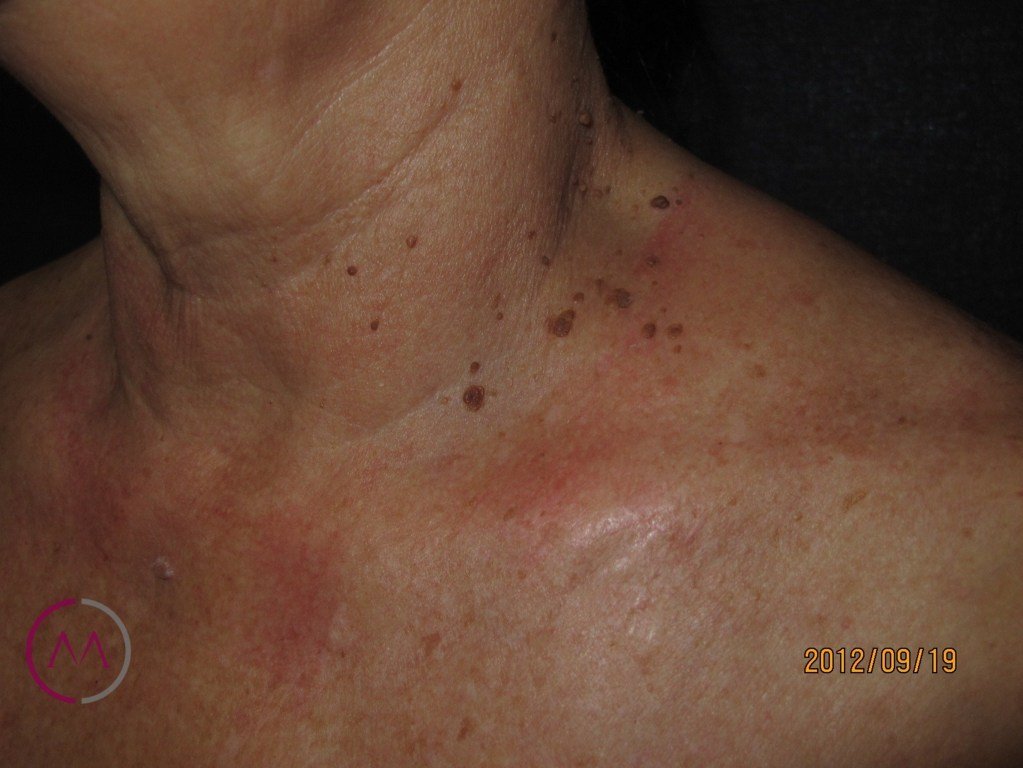 Before image