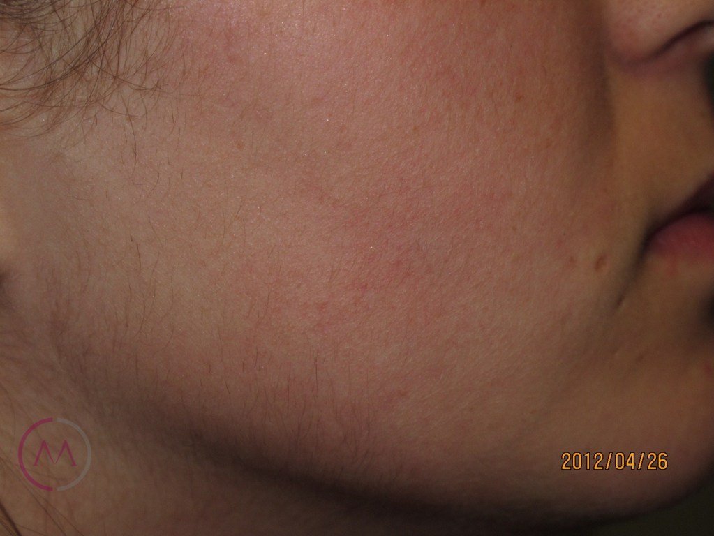 After image