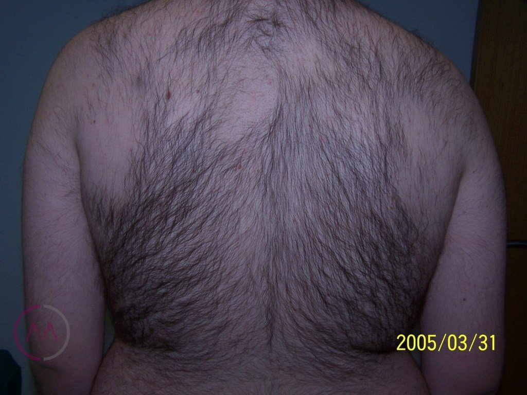 Before image