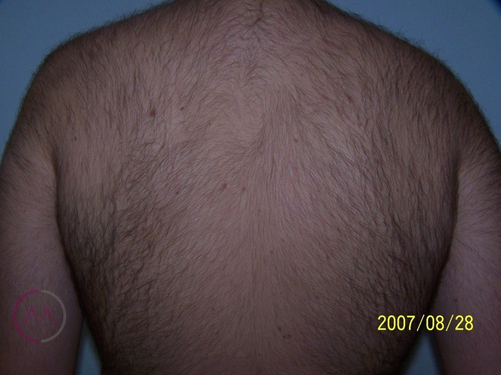 After image