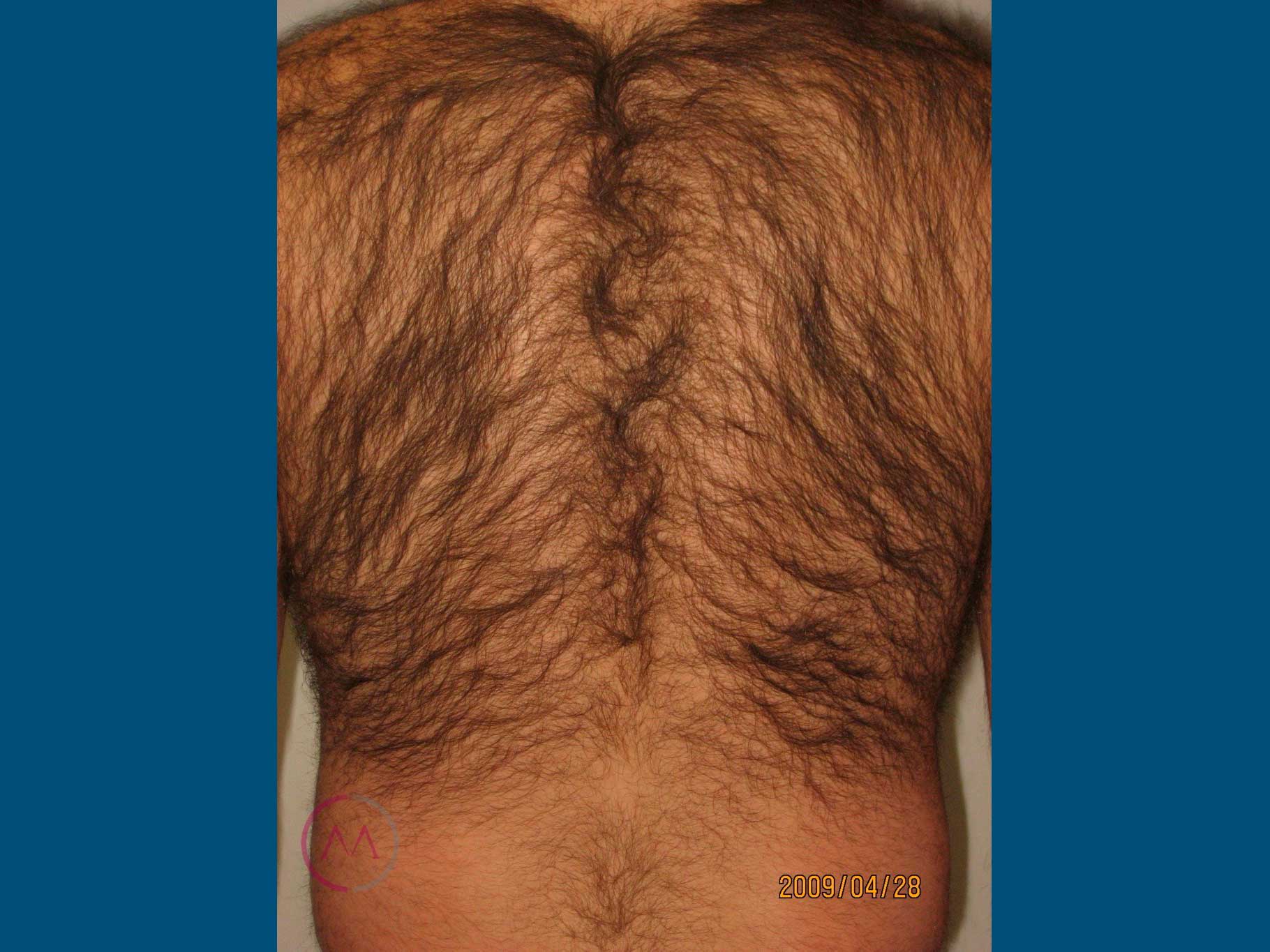 Before image