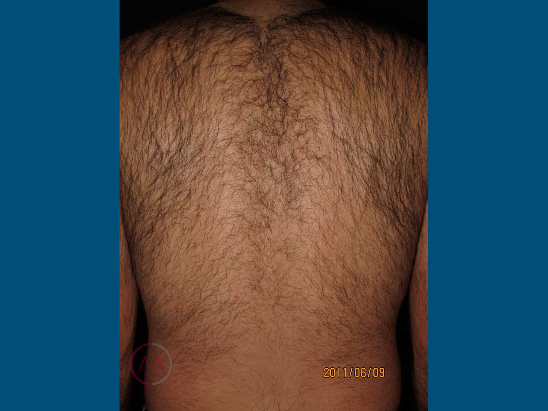 After image