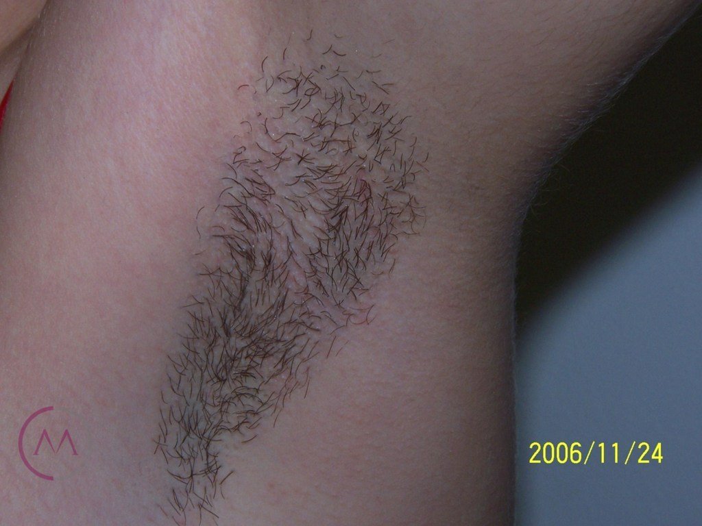 Before image