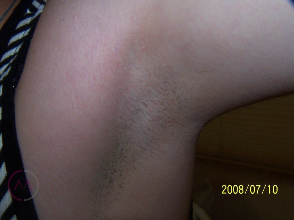After image