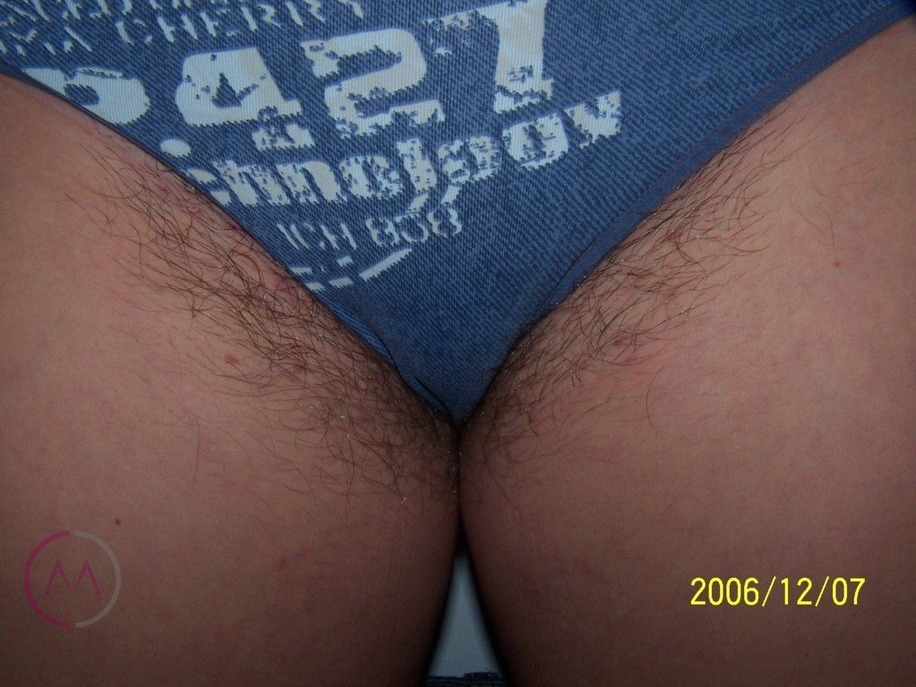 Before image