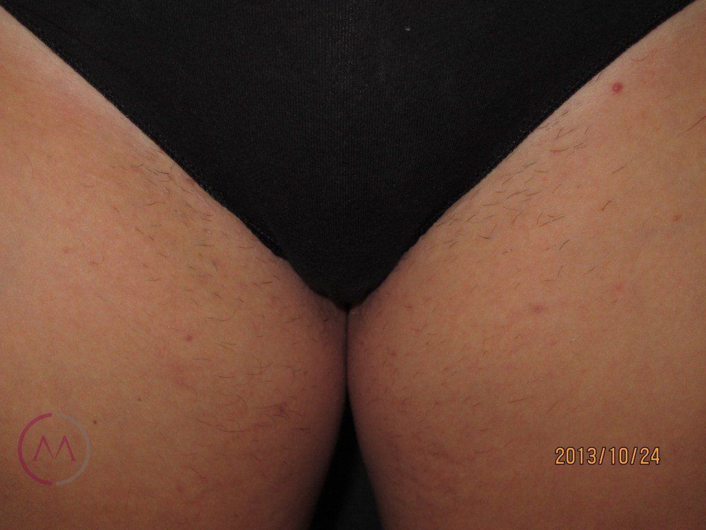 After image